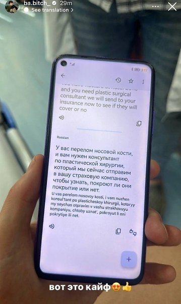 Артур Бабич получил травму и сломал нос. Он шутливо написал в своих историях: