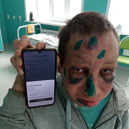 , 34, 