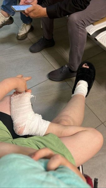 Во Владивостоке сосед натравил питбуля на женщину с ребенком, которые пришли разбираться из-за ...