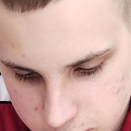 , , 18 