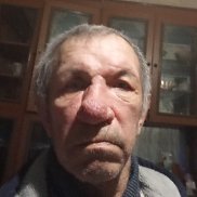 ���������, 65 ���, �����������