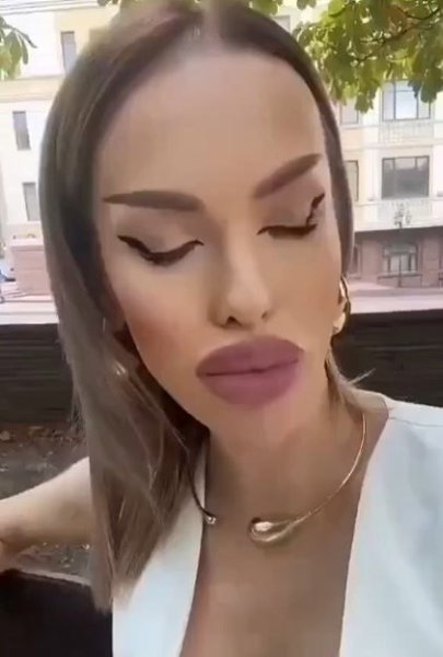 Первый раз вижу столько ботокса. Не то что улыбаться не может, а даже моргать - 2