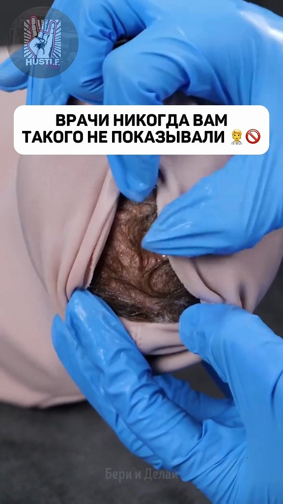       - 2