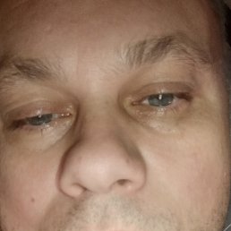 , 35, 