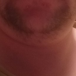 ���������, �����-�������, 35 ���