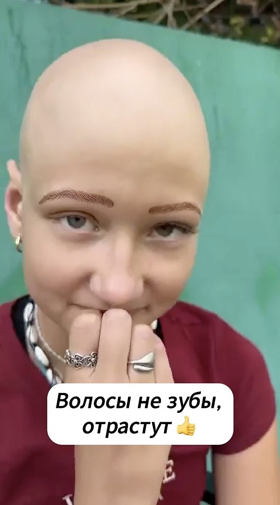   . - 2