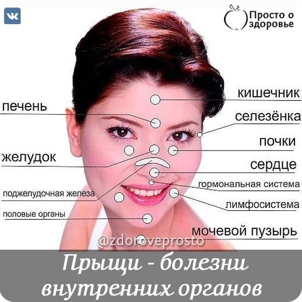 Прыщи - болезни внутренних органов.Каким образом определить прыщи и их связь с внутренними ...